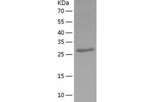 Western Blotting (WB) image for Calbindin 2 (CALB2) (AA 1-271) protein (His-IF2DI Tag) (ABIN7122076)