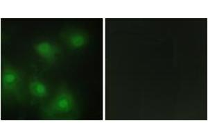 Immunofluorescence analysis of HeLa cells, using CDK2 Antibody.