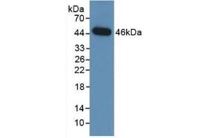 Detection of Recombinant NEU, Human using Monoclonal Antibody to Neuraminidase (NEU) (NEU1 anticorps  (AA 47-415))
