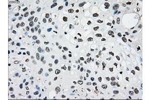 Image no. 8 for anti-Premelanosome Protein (PMEL) antibody (ABIN1500300)