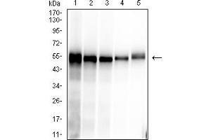 Western blot analysis using SARS-CoV-2-NP1 mAb against human SARS-CoV-2-N (AA: 1-419) recombinant protein. (SARS-Cov2-NP1 (AA 1-180) anticorps)