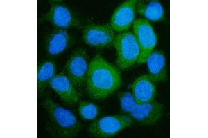 IF analysis of GLUL using anti-GLUL antibody (ABIN7602403). (GLUL anticorps  (AA 74-373))
