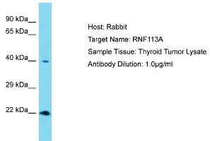 Host: Rabbit Target Name: RNF113A Sample Tissue: Human Thyroid Tumor Antibody Dilution: 1ug/ml (RNF113A anticorps  (N-Term))