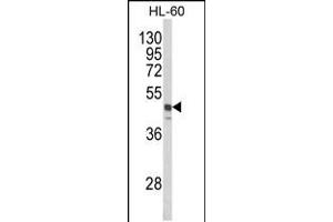 Western blot analysis of SNX6 Antibody in HL-60 cell line lysates (35ug/lane) (SNX6 anticorps)