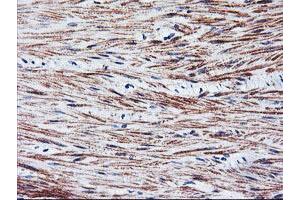 Immunohistochemical staining of paraffin-embedded Human colon tissue using anti-TAL1 mouse monoclonal antibody. (TAL1 anticorps)