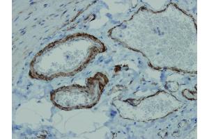 Immunohistochemistry (IHC) image for anti-Actin, alpha 2, Smooth Muscle, Aorta (ACTA2) (AA 3-16), (N-Term) antibody (ABIN7598830)