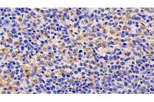 Detection of TSLP in Human Spleen Tissue using Monoclonal Antibody to Thymic Stromal Lymphopoietin (TSLP)