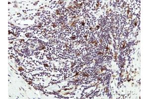 Immunohistochemical staining of paraffin-embedded Human lymph tissue using HICE1 antibody at a dilution of 1:50 (NYS48/HAUS8 anticorps)