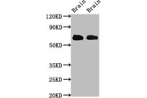 Western Blot Positive WB detected in: Rat brain tissue, Mouse brain tissue All lanes: SLC1A2 antibody at 3.