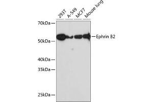 Western blot analysis of extracts of various cell lines, using Ephrin B2 Rabbit mAb (ABIN7266978) at 1:1000 dilution. (Ephrin B2 anticorps)