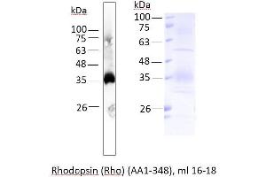 Image no. 1 for Rho-related GTP-binding protein (RhO (pan)) (AA 1-348) protein (ABIN3085265) (Rho-related GTP-binding protein Protein (RhO (pan)) (AA 1-348))