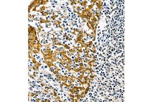 Immunohistochemistry analysis of paraffin embedded human tonsil using CK6 (ABIN7074423) at dilution of 1: 1000 (Keratin 6 anticorps)
