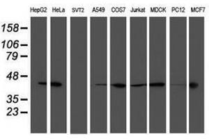 Image no. 2 for anti-Spermine Synthase, SMS (SMS) antibody (ABIN1501095)
