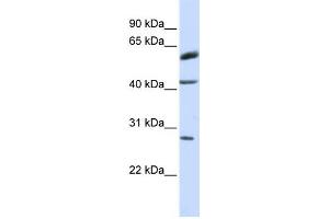 Western Blotting (WB) image for anti-Ring Finger Protein 170 (RNF170) antibody (ABIN2458738) (RNF170 anticorps)