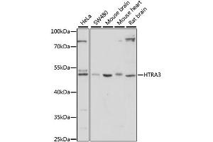 Western blot analysis of extracts of various cell lines, using HTRA3 antibody.