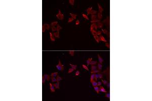 Immunofluorescence analysis of MCF7 cells using RAMP3 antibody.