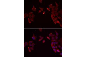 Immunofluorescence analysis of MCF7 cells using RAMP3 antibody. (RAMP3 anticorps  (AA 1-118))