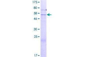 Image no. 1 for Solute Carrier Family 25 (Mitochondrial Carrier, Adenine Nucleotide Translocator), Member 31 (SLC25A31) (AA 1-315) protein (GST tag) (ABIN1320285)