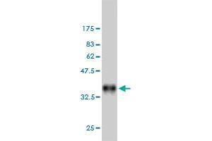 Western Blot detection against Immunogen (35. (DAPK2 anticorps  (AA 281-370))