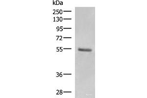 Western blot analysis of Human skin tissue lysate using KRT36 Polyclonal Antibody at dilution of 1:1000 (Keratin 36 anticorps)