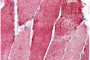 Human Skeletal Muscle: Formalin-Fixed, Paraffin-Embedded (FFPE)