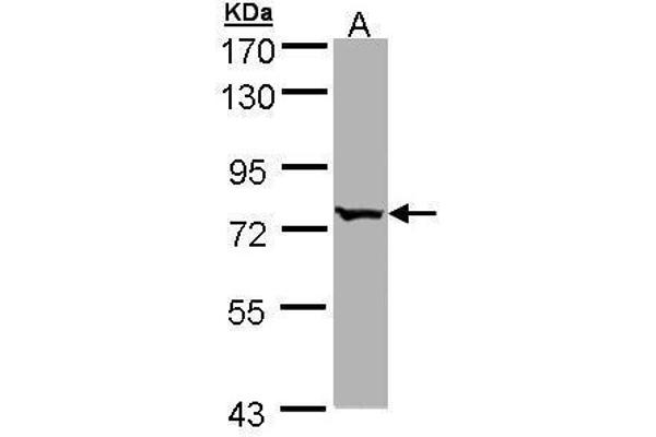BBS10 anticorps