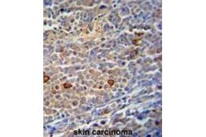 Immunohistochemistry (IHC) image for anti-Chromosome 9 Open Reading Frame 156 (C9orf156) antibody (ABIN3002894) (C9orf156 anticorps)
