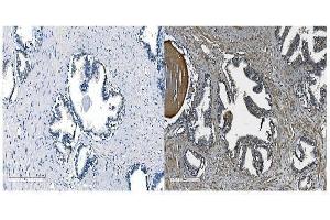 IHC analysis of OB Cadherin/CDH11 using anti-OB Cadherin/CDH11 antibody (ABIN5518978). (OB Cadherin anticorps  (AA 55-293))