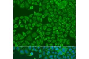 Immunofluorescence analysis of U2OS cells using FXR2 Polyclonal Antibody at dilution of 1:100.