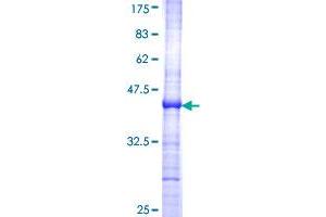 Fibroblast Growth Factor 10 (FGF10) (AA 38-137) protein (GST tag)