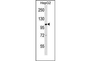 Western blot analysis of KIF18A Antibody (C-term) in HepG2 cell line lysates (35ug/lane). (KIF18A anticorps  (C-Term))