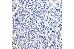 Immunohistochemistry of paraffin-embedded Human esophageal using CDK6 Rabbit pAb (ABIN7266595) at dilution of 1:100 (40x lens). (CDK6 anticorps  (AA 1-326))