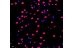 Immunofluorescence of paraffin embedded rat brain using PABPN1 (ABIN7075116) at dilution of 1:600 (400x lens) (PABPN1 anticorps)