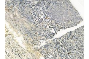 ABIN6260586 and ABIN6276860 at 1/100 staining human normal tonsil tissue by IHC-P.