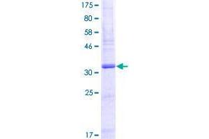 Image no. 1 for Secreted LY6/PLAUR Domain Containing 1 (SLURP1) (AA 1-103) protein (GST tag) (ABIN1320581)