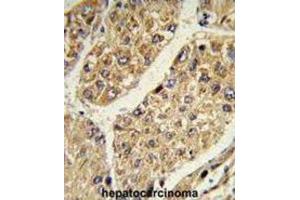 Immunohistochemistry (IHC) image for anti-Chondroitin Sulfate N-Acetylgalactosaminyltransferase 2 (CSGALNACT2) antibody (ABIN3003905)