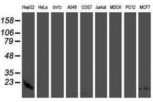 Image no. 2 for anti-Cystatin C (CST3) antibody (ABIN1497755) (CST3 anticorps)