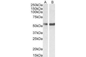 Image no. 3 for anti-Polypyrimidine Tract Binding Protein 1 (PTBP1) antibody (ABIN5874678) (PTBP1 anticorps)