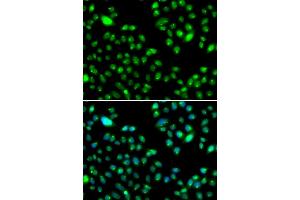Immunofluorescence analysis of MCF-7 cells using L3MBTL3 antibody.