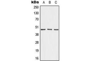 Western blot analysis of AKAP5 expression in MDAMB231 (A), NIH3T3 (B), H9C2 (C) whole cell lysates. (AKAP5 anticorps  (N-Term))