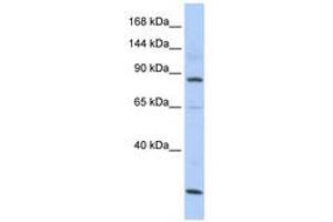 Image no. 1 for anti-MutS Homolog 5 (MSH5) (AA 107-156) antibody (ABIN6740728) (MSH5 anticorps  (AA 107-156))