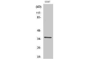 Western Blotting (WB) image for anti-FBJ Murine Osteosarcoma Viral Oncogene Homolog B (FOSB) (Ser392) antibody (ABIN3184648)
