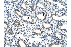 Image no. 1 for anti-Keratin 18 (KRT18) (C-Term) antibody (ABIN203132) (Cytokeratin 18 anticorps  (C-Term))