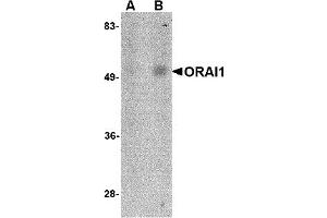 Western Blotting (WB) image for anti-ORAI Calcium Release-Activated Calcium Modulator 1 (ORAI1) (C-Term) antibody (ABIN492546) (ORAI1 anticorps  (C-Term))