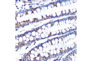 Immunohistochemistry of paraffin-embedded human colon using LOX Rabbit mAb (ABIN7268347) at dilution of 1:100 (40x lens).