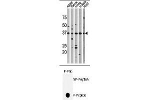 Image no. 1 for anti-Tumor Protein P53 (TP53) (pThr18) antibody (ABIN358195) (p53 anticorps  (pThr18))