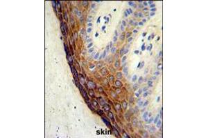 Formalin-fixed and paraffin-embedded human skin tissue reacted with ECE-1 Antibody , which was peroxidase-conjugated to the secondary antibody, followed by DAB staining.