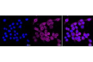 Immunocytochemical staining of HeLa cells with KSR1 antibody (ABIN7799197), 1:1,000).