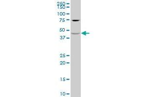KCNJ16 polyclonal antibody (A01), Lot # 060707JCS1 Western Blot analysis of KCNJ16 expression in HeLa .