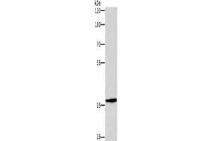 Gel: 8 % SDS-PAGE, Lysate: 40 μg, Lane: Hela cells, Primary antibody: ABIN7190518(DUSP2 Antibody) at dilution 1/300, Secondary antibody: Goat anti rabbit IgG at 1/8000 dilution, Exposure time: 1 minute (DUSP2 anticorps)